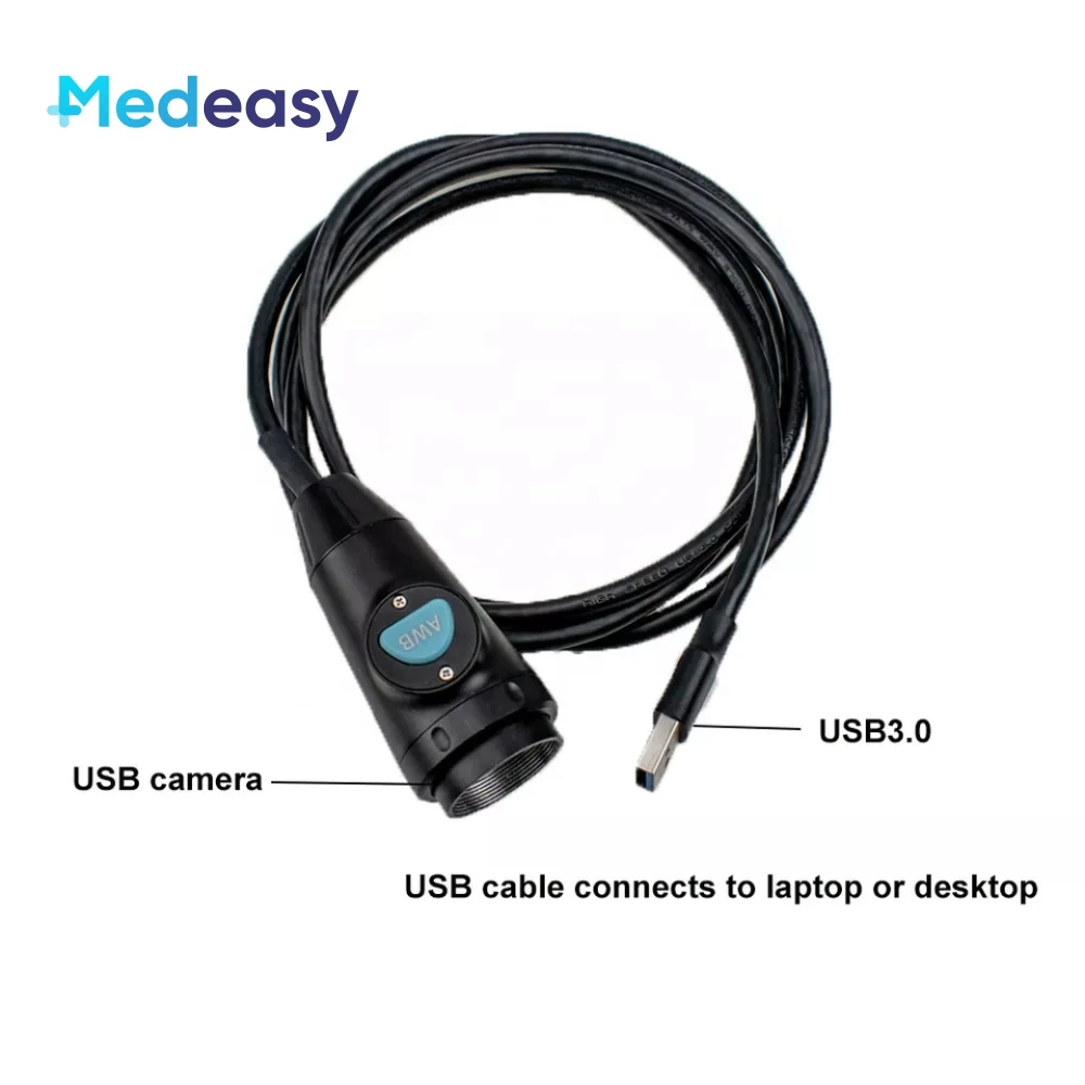 Medical Portable Full HD 1080P USB Endoscope Camera for ENT