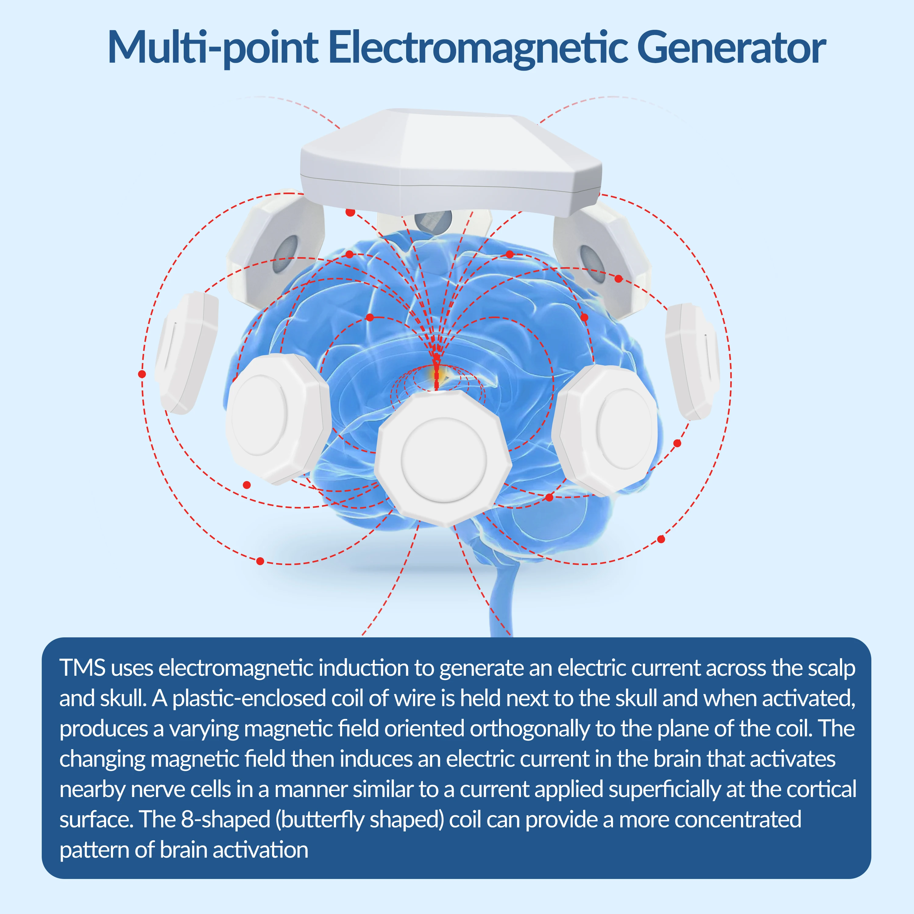 ZJZK TMS Magnetic Brain Therapy For Pain Obsessive-Compulsive Disorder (OCD) Amyotrophic Lateral Sclerosis Stroke Rehabilitation