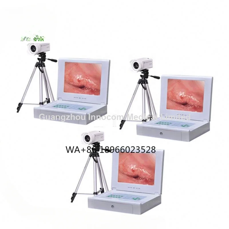 colposcopy for gynecology well infrared colposcopy equipment Wholesale price medical equipment portable digital electronic