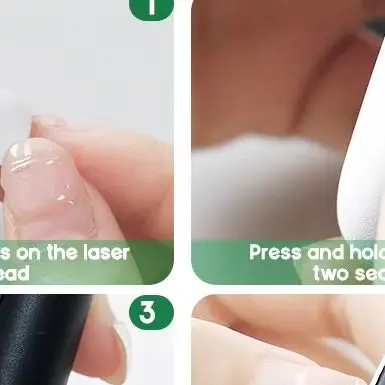 

Портативный лазерный облучатель для носа и ушных каналов, перезаряжаемый лазерный ушной облучатель 650 нм, уменьшающий шум в ушах