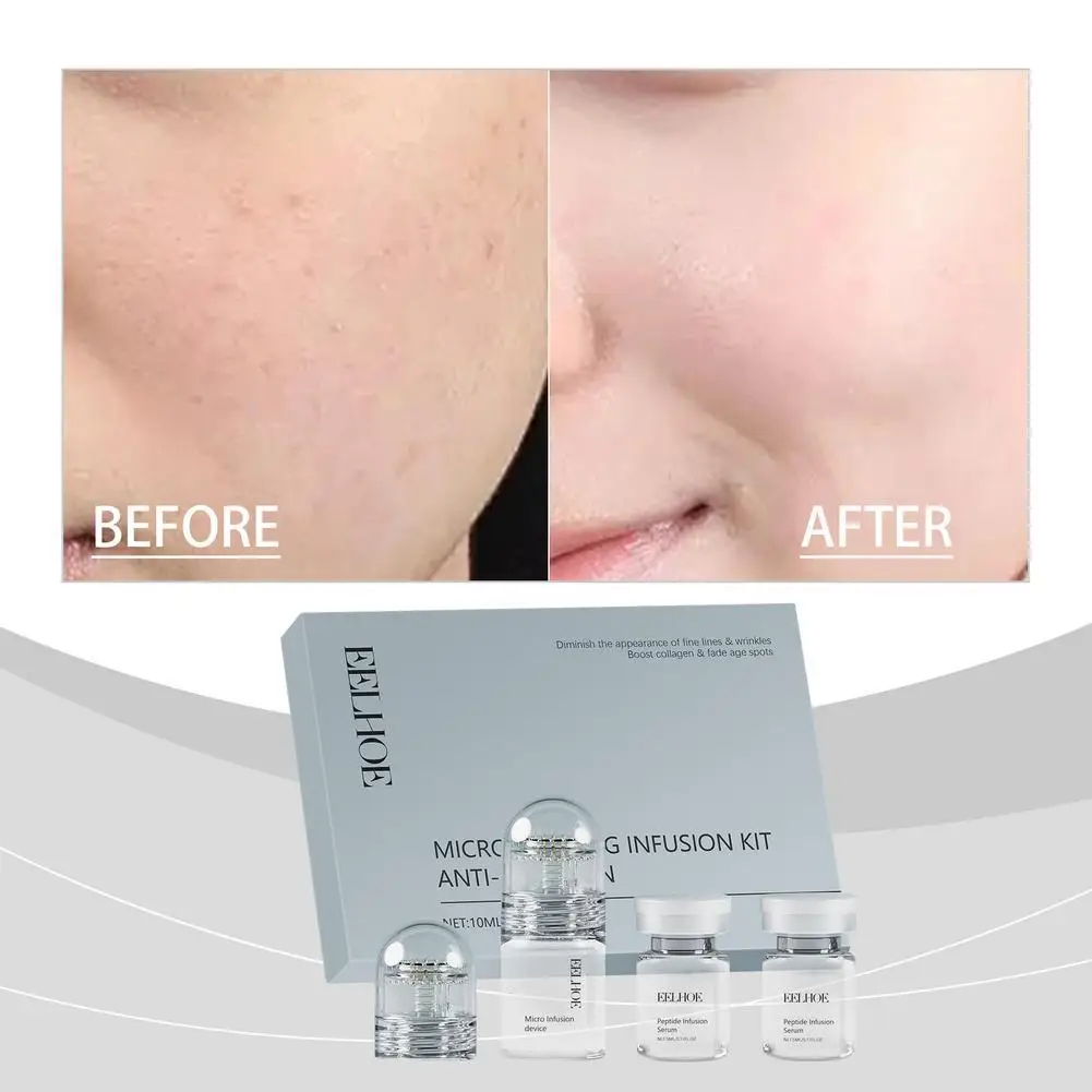Thumbnail 2 - #21 Skin Care Rollers Comparison Guide