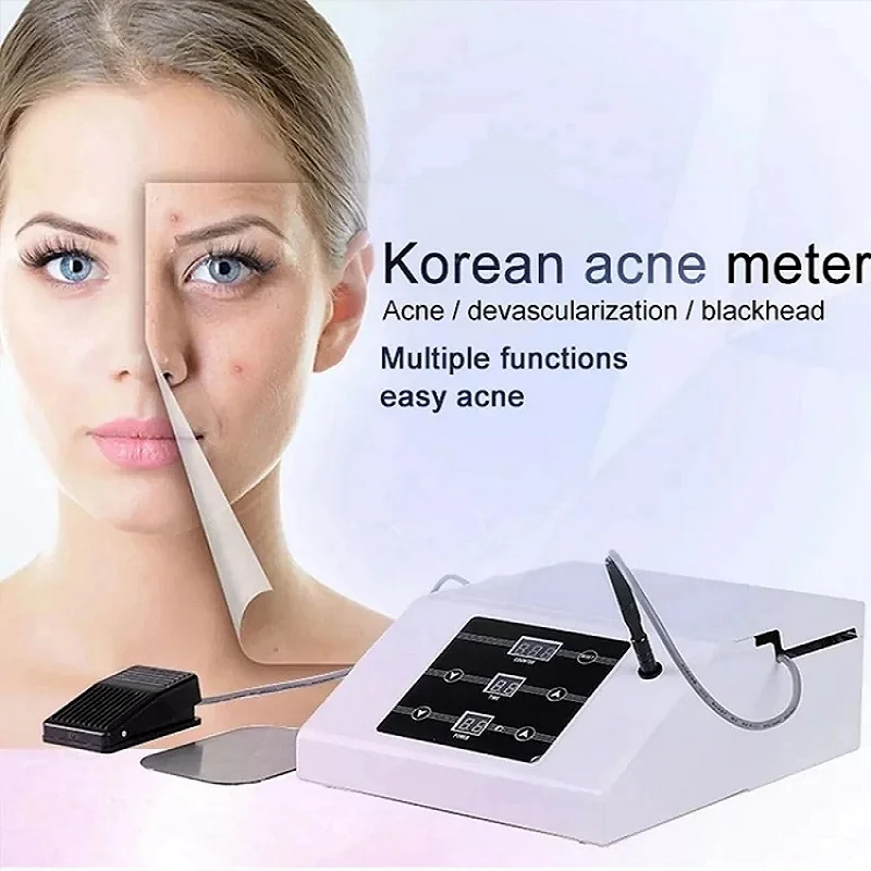 Beauty Acacia Acne Treatment RF Sweat Tube Tumor Remove Blackheads Acne Removal Machine