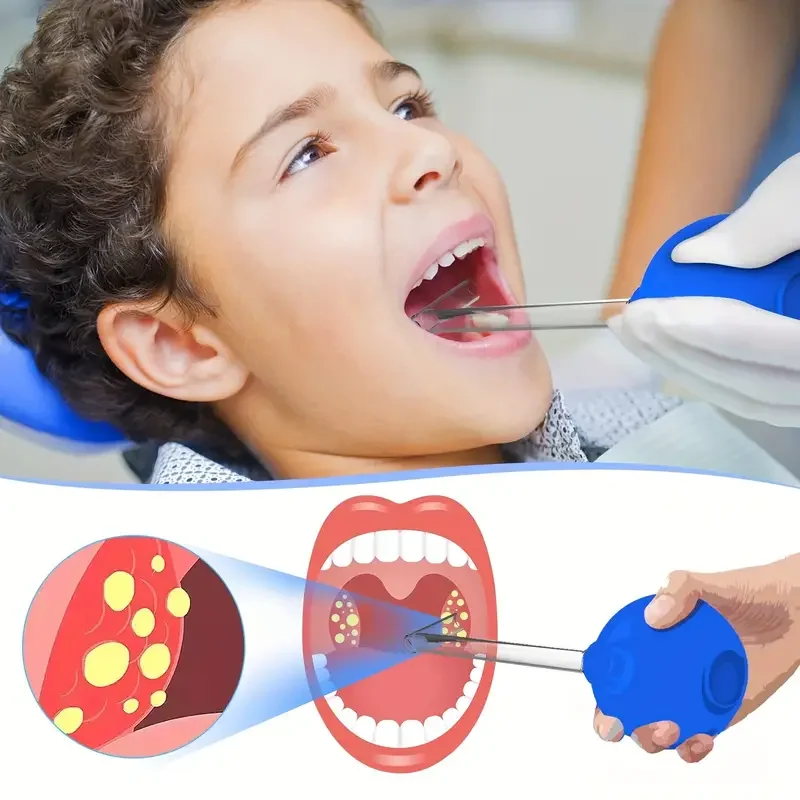 Kit de vacío eliminador de piedra de Tonsil, con bola de succión, cuidado bucal de limpieza, herramientas de ventosas dentales