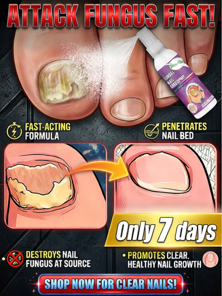 

Восстановите свои ногти до нормального состояния.