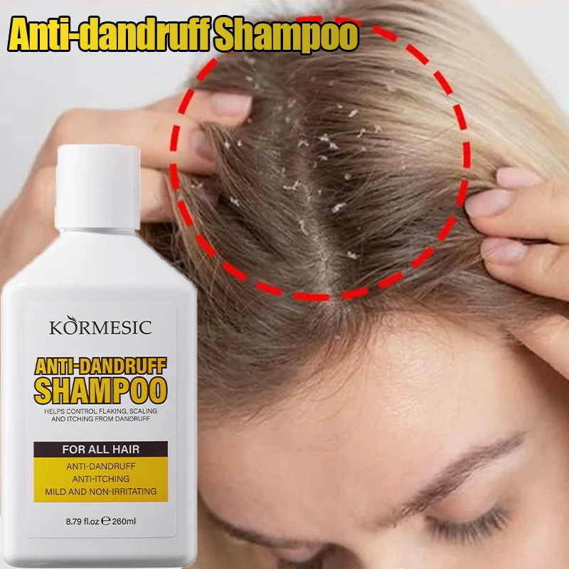 

260 мл шампунь против перхоти, глубоко очищающий, уменьшает кожу головы, зуд, баланс, масло, укрепляет корни волос, успокаивает, пушистые волосы, уход за красотой