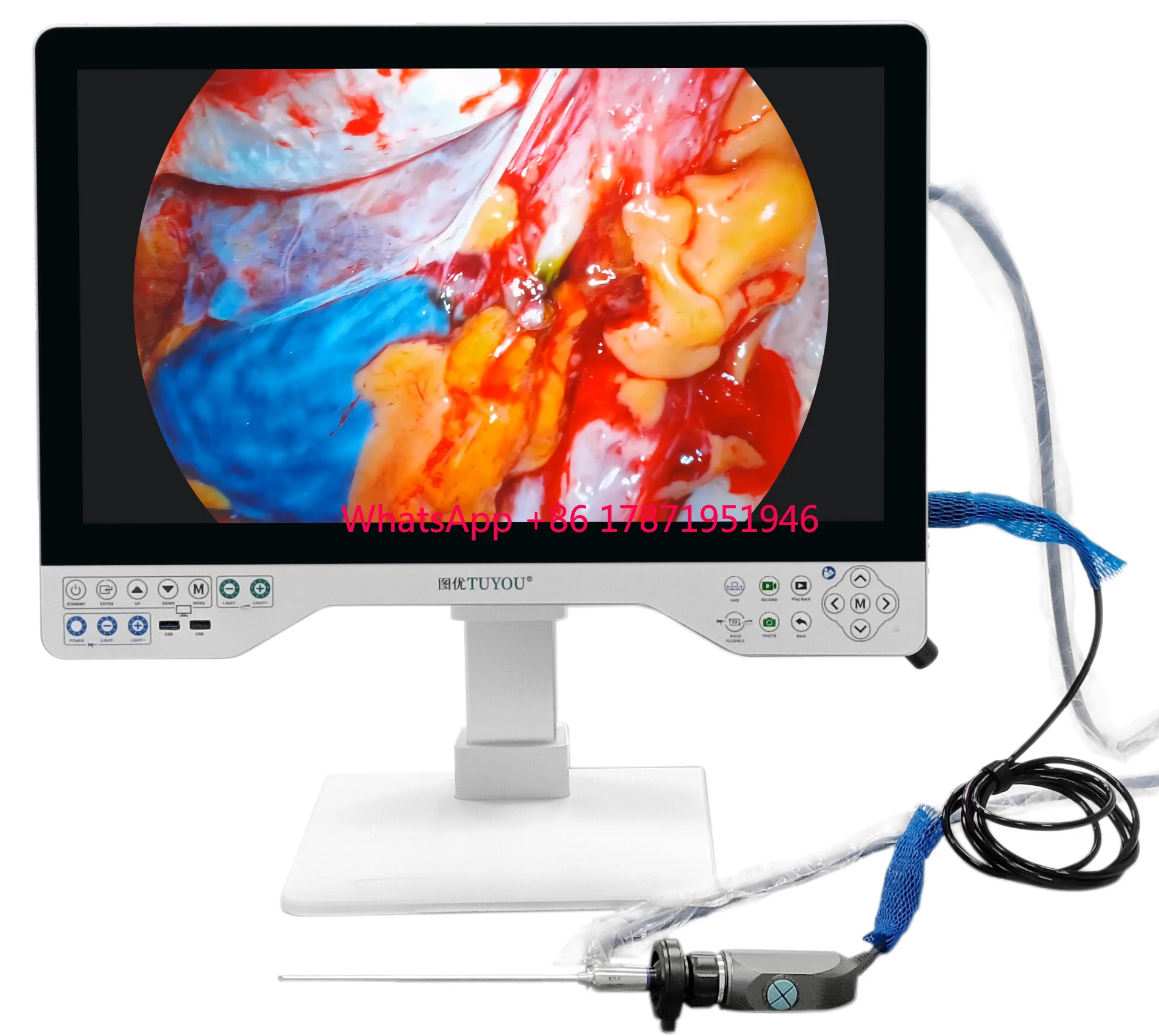 Hot Sales Class I 1080P Medical Endoscopy Camera System Full HD Display