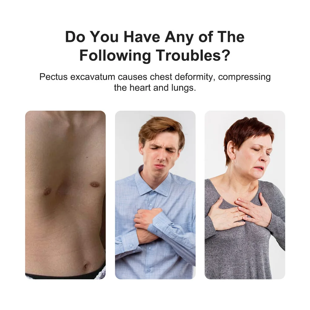 Electric Pectus Correction Rehabilitation For Funnel Chest Orthopedic Brace Pectus Excavatum Brace Vacuum Bell Pectus Excavatum