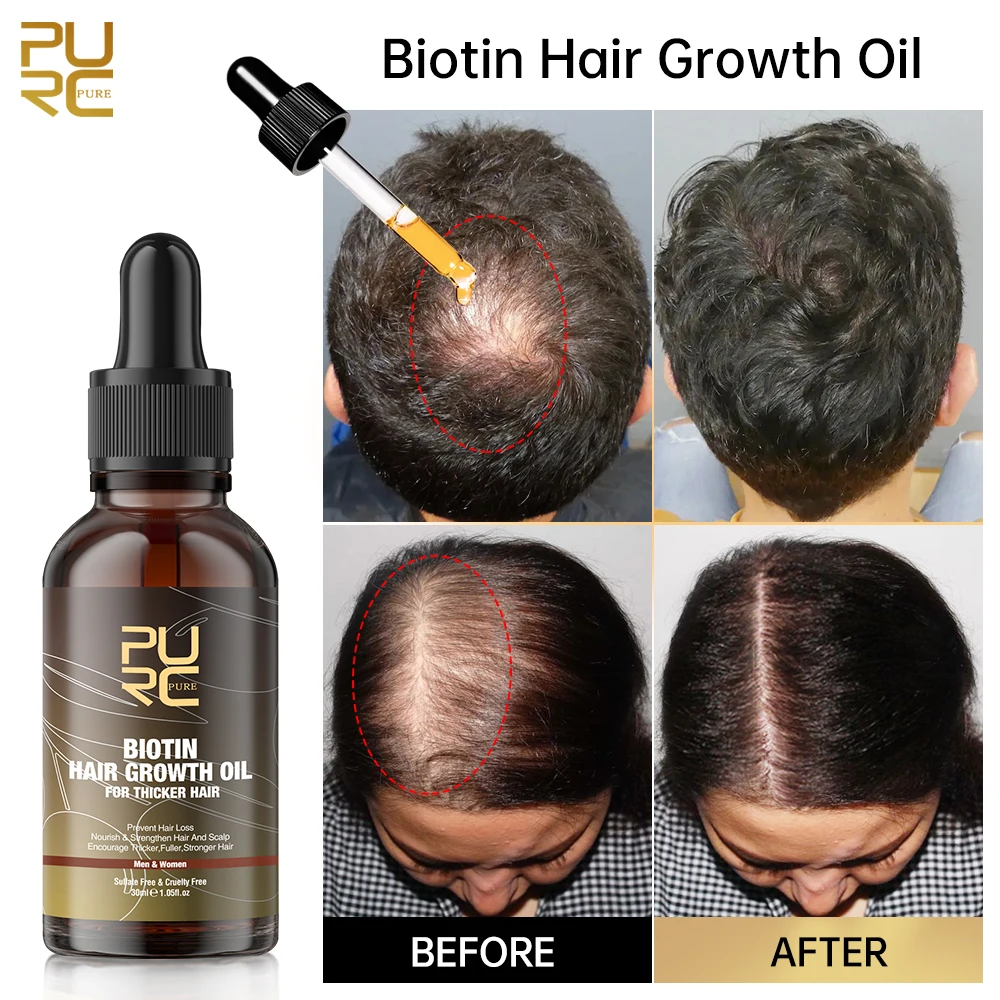 Biotin Hair Oil For Hair Growth Anti Hair Loss Nourishing Volumizing Strenghtening Treatment Hair Growth Product for Men Women