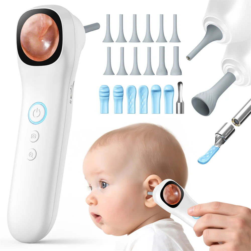 

Цифровая ушная камера с 1,21-дюймовым IPS-экраном 1080p HD Smart Visual Ear Care с инструментом для ухода за ушами/носом/ротом/домашними животными/кожами