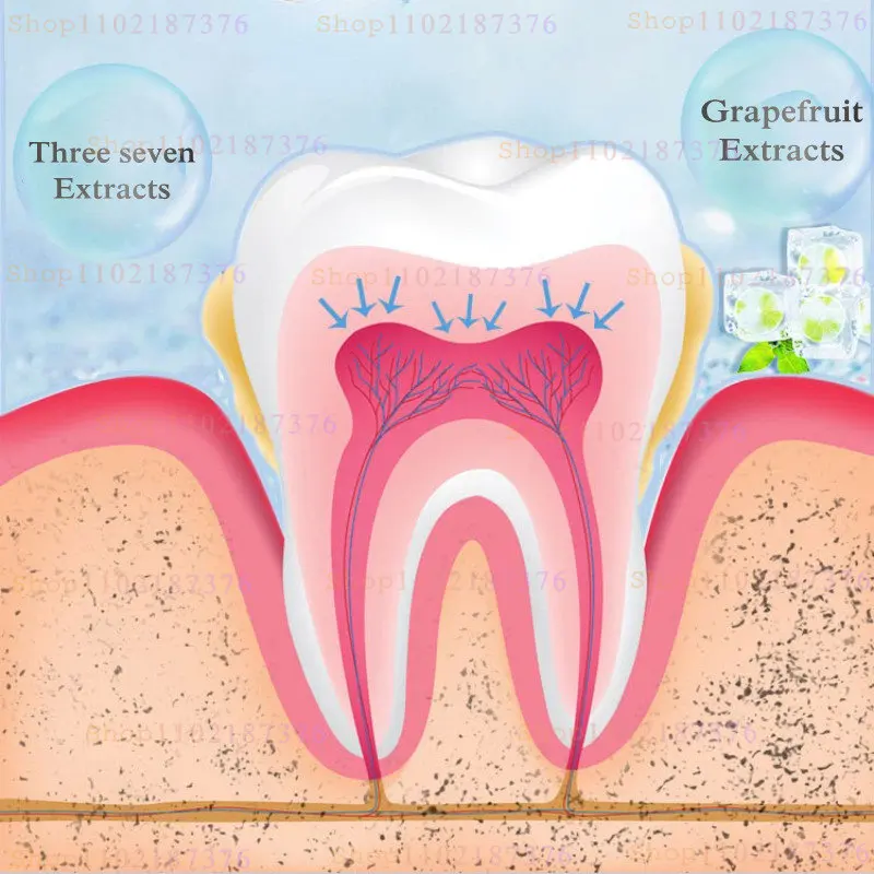 Probiotic Toothpaste Quickly Improves Tooth Decay, Relieves Gum Swelling and Pain, Removes Tooth Stains and Bad Breath