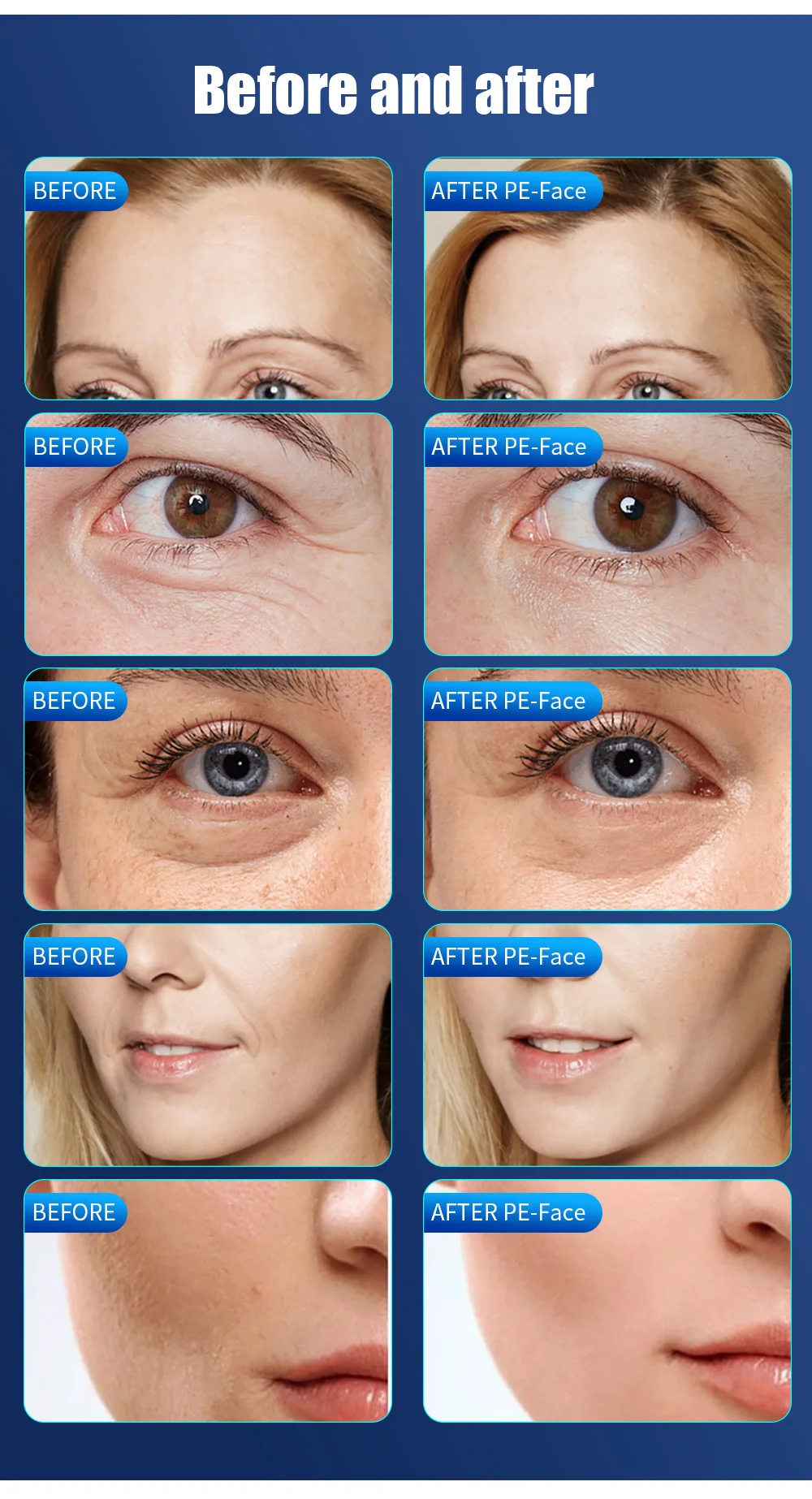 صالون تجميل جديد آلة إزالة الشعر بالليزر IPL محمولة للغاية معدات احترافية لإزالة الشعر الدائم بالليزر ديود #1