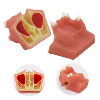 植牙實踐模型:下顎竇軟性牙齦模型,適用於牙醫學生訓練教學示範診所模型 8 最佳銷售 牙醫學生 - №3