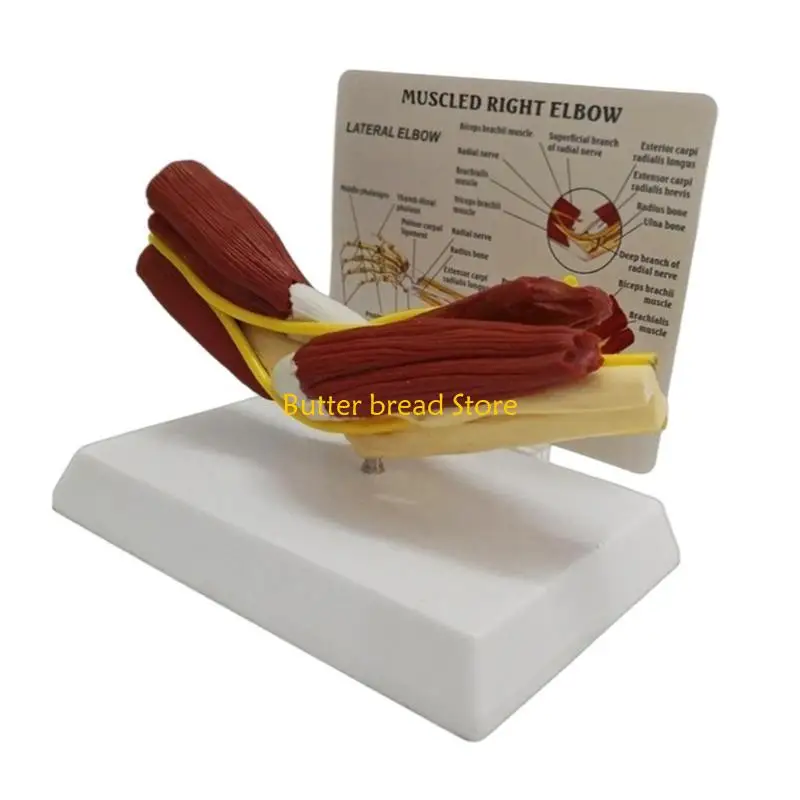 W89C筋肉質の右肘関節解剖学モデル専門教育トレーニングのための解剖学的肘関節筋神経モデル