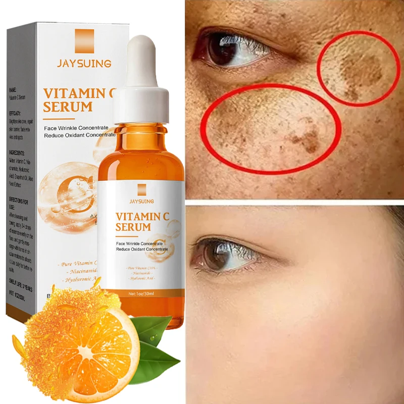 Vitamin C Whitening Serum Face Remove Dark Spots Freckles Fade Melanin Retinol Anti-wrinkle Essence Brightening Korean Skin Care