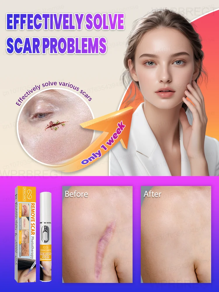 Herramientas de dispositivo de belleza para reparación de cuidado de la piel con láser para mujeres 	 y hombres