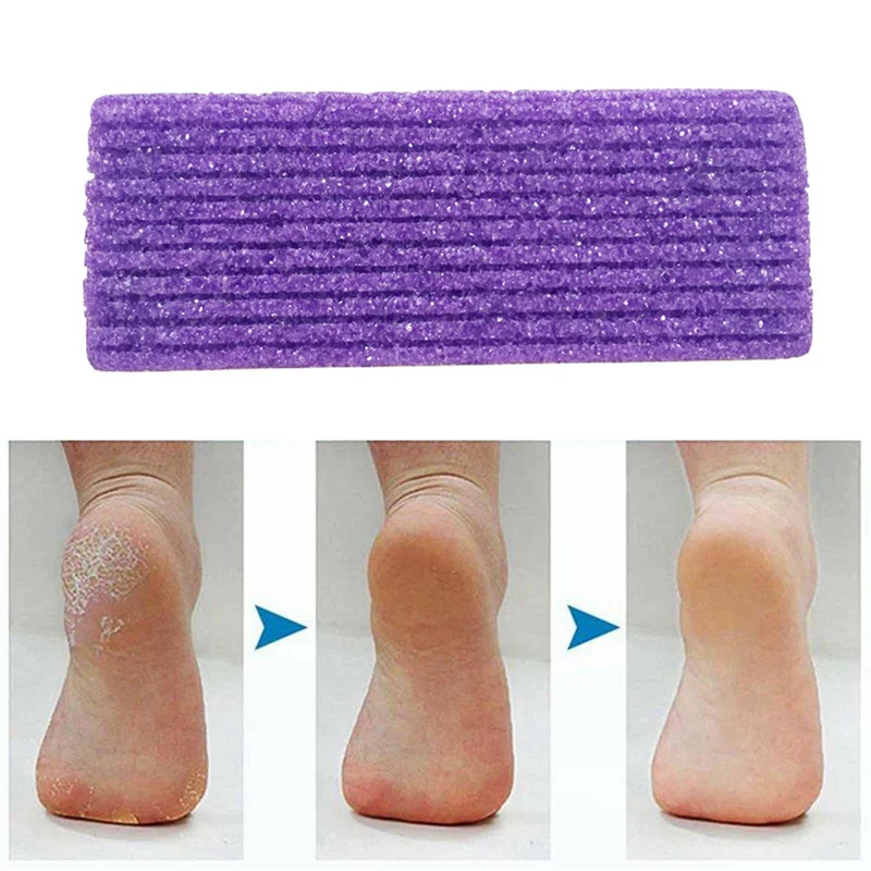 4 Stuks Puimsteen Pedicure Voor Voet Callus Exfoliëren Harde Huid Verwijderen Pedicure Scrubber