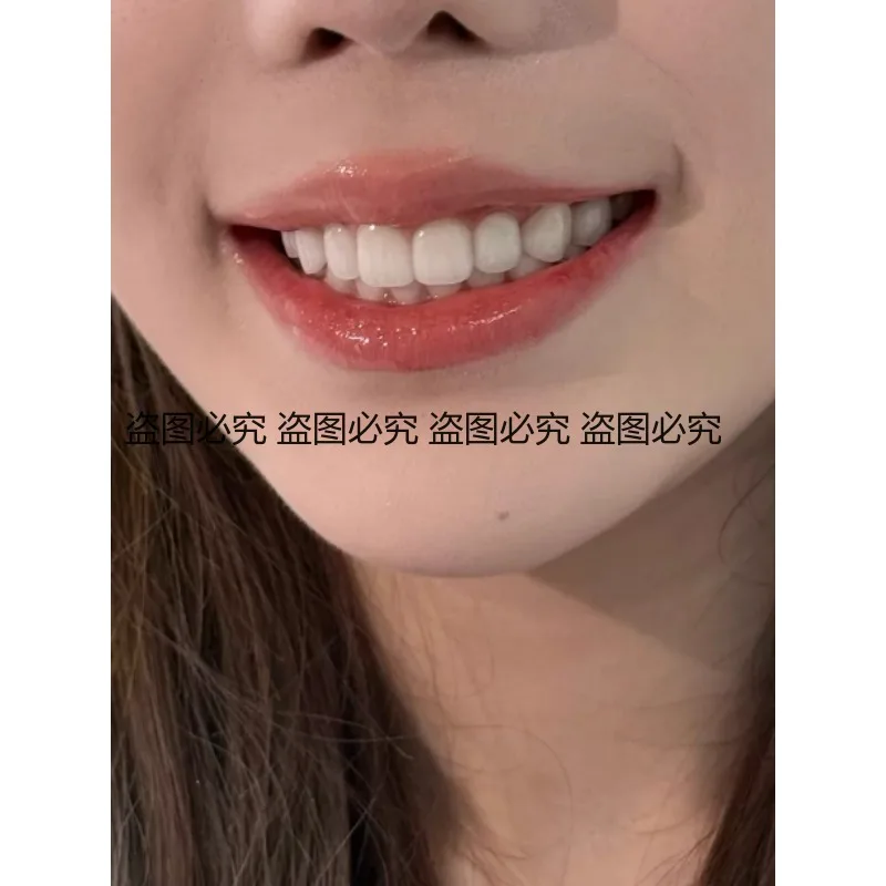Resin Temporary False Teeth Removable Invisible Dentures Custom Snap on Teeth for Front Tooth Cover Comfortable for Daily Eating