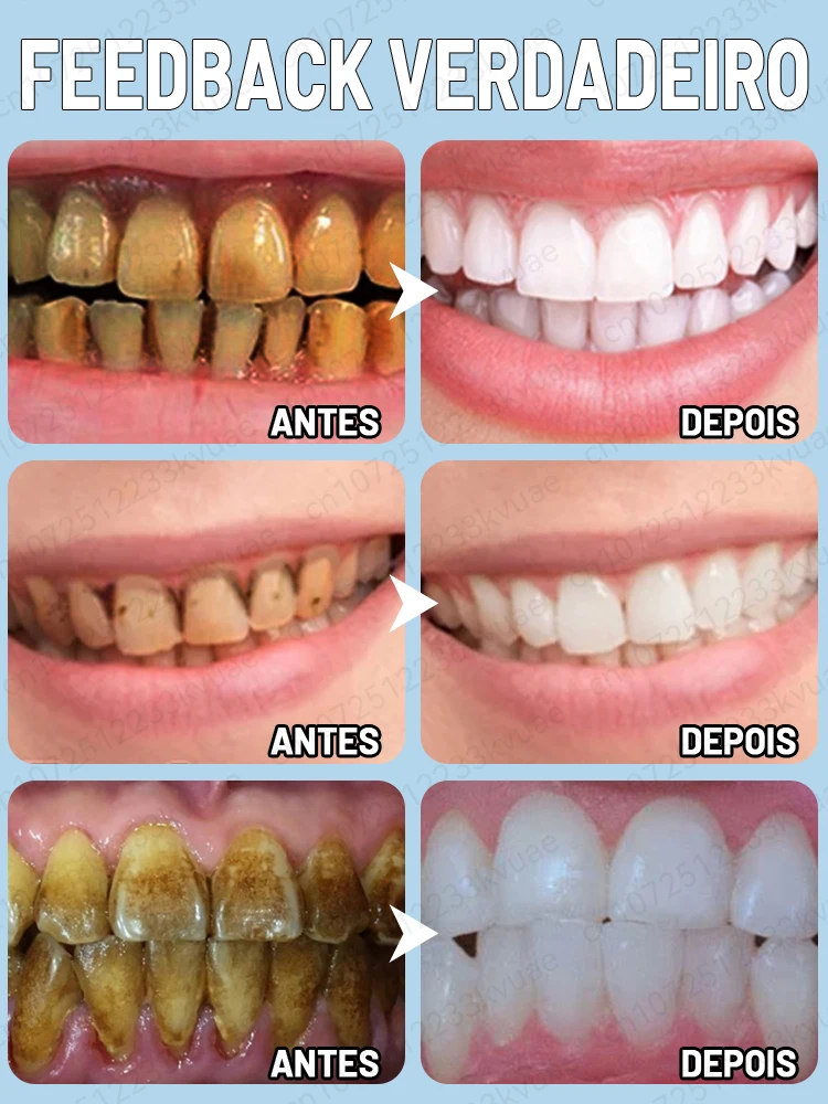 Dentes branqueamento creme dental, respiração clara e remover manchas