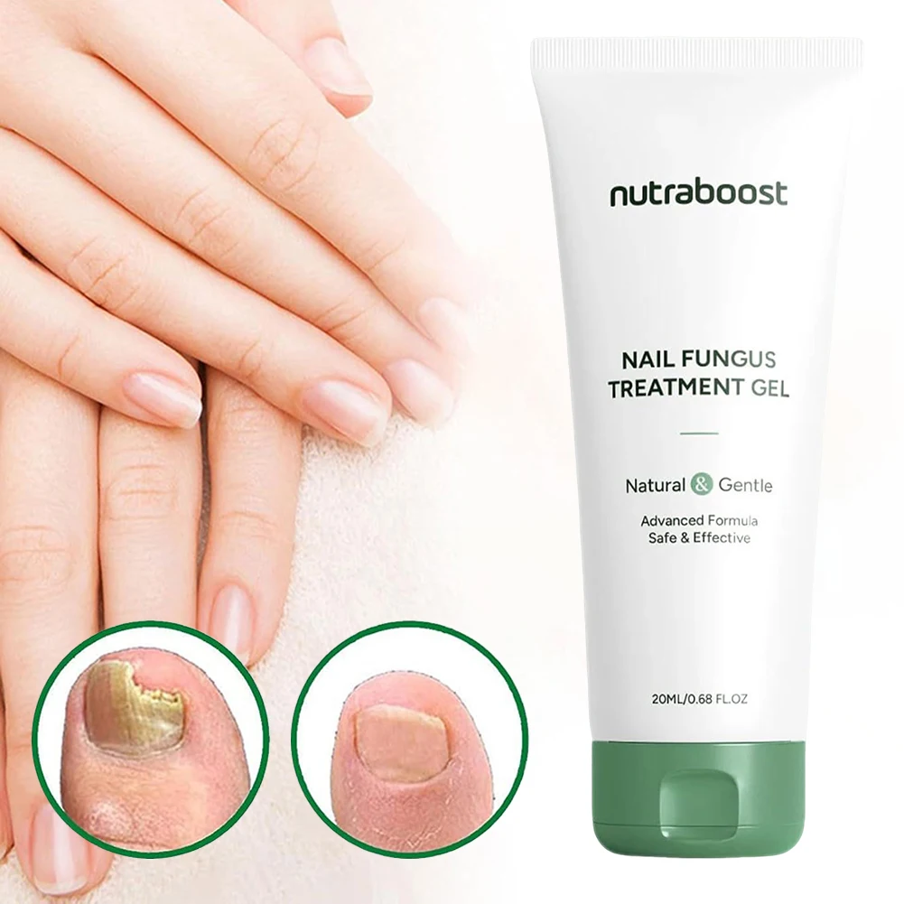 ครีมทามือไม่เหนียวเหนอะหนะบำรุงมือและเท้าเซรั่มดูแลเล็บสำหรับฤดูหนาวเนื้อเจลแห้งดูดซึมง่ายการรักษาเชื้อราที่เล็บ 20 มล