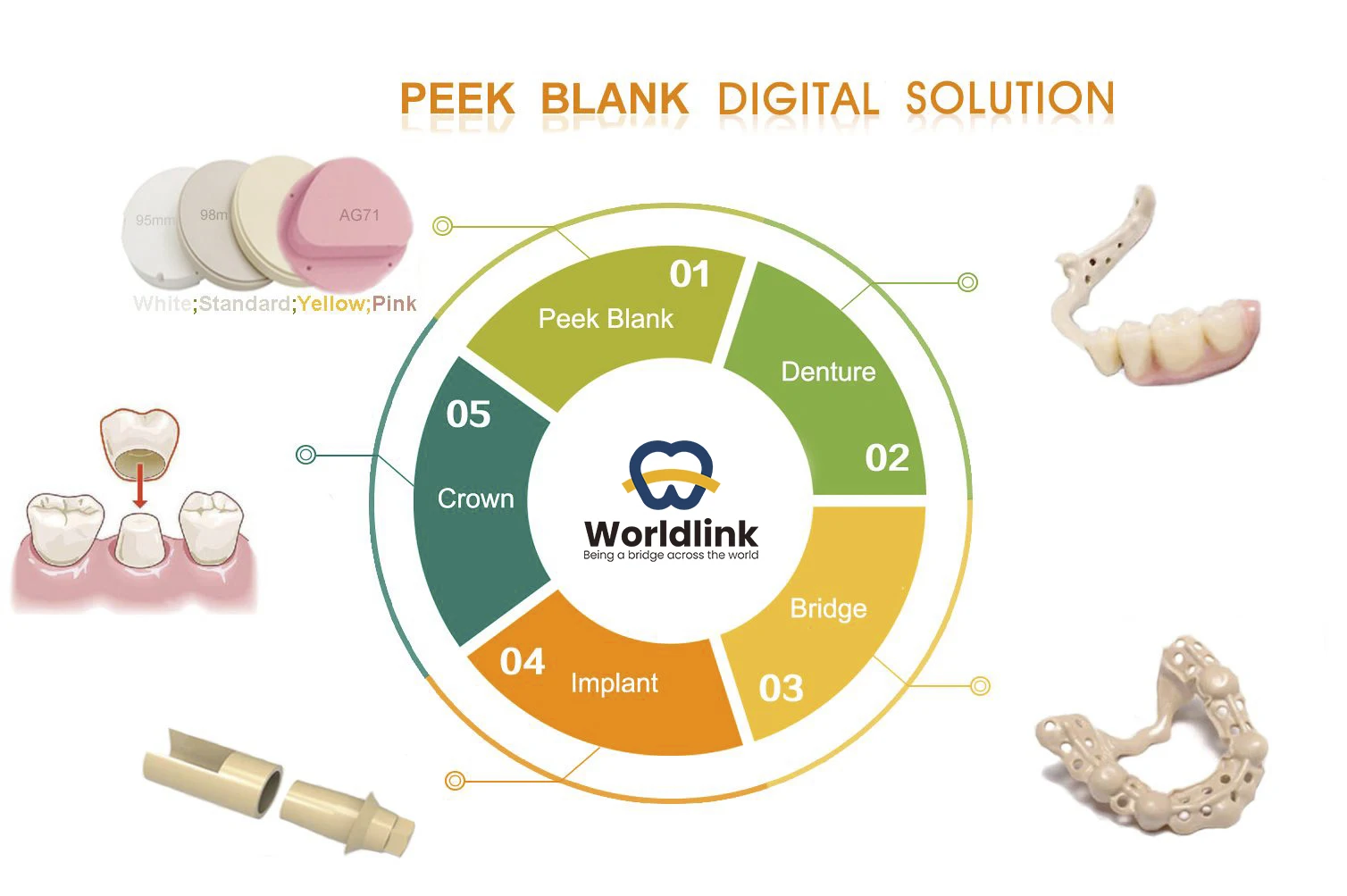 WorldLink Dental Milling Peek Blank 98MM Cutting Size Highly Biocompatible False Teeth Holder for Lab Use