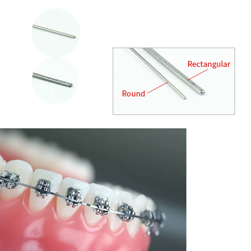 

5 упаковок VVDental Ni-Ti, суперэластичные ортодонтические прямоугольные/круглые дуги, натуральные/иставшие брекеты для зубов, брекеты, стоматологические инструменты