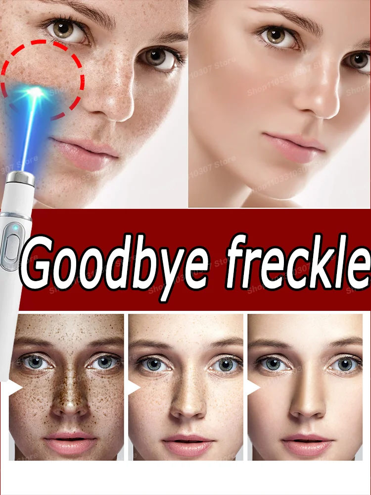 Repair of Facial dark spots