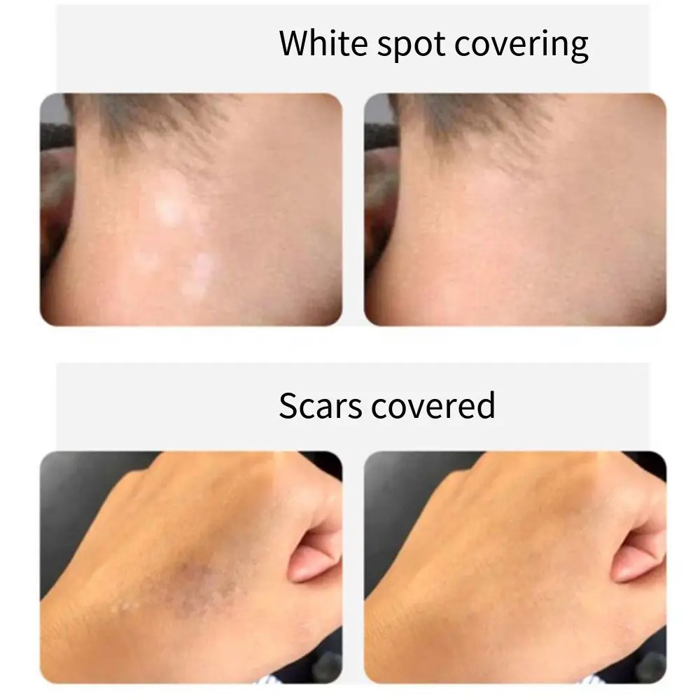 8Pcs Skin Color Tattoo Cover Up Sticker Temporary Sweatproof Scar Concealer Sticker Breathable Waterproof Skin Repair Patch