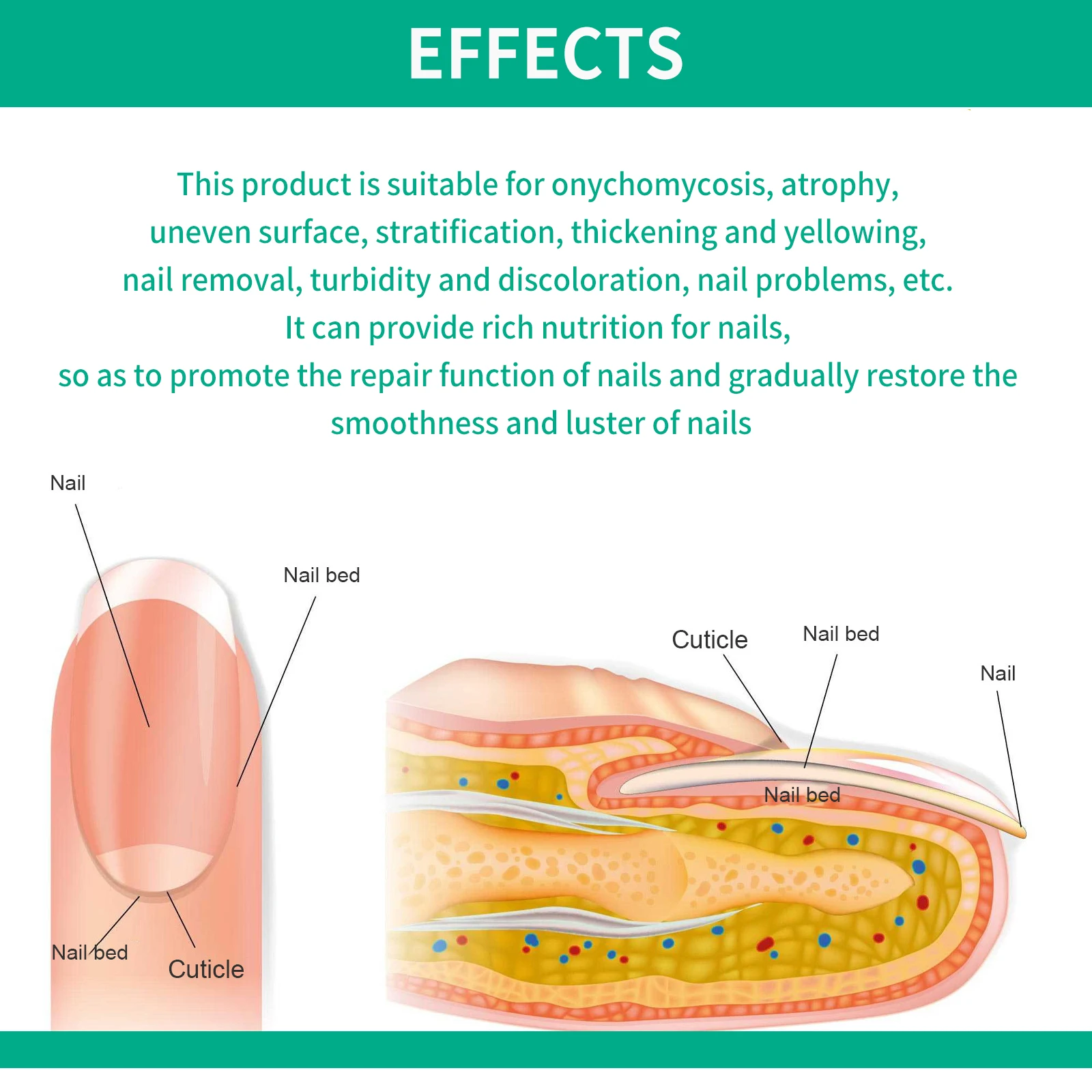 Toenail Fungus TreatmenT for Thick, Broken, Discolored and Damaged Nail 30ml