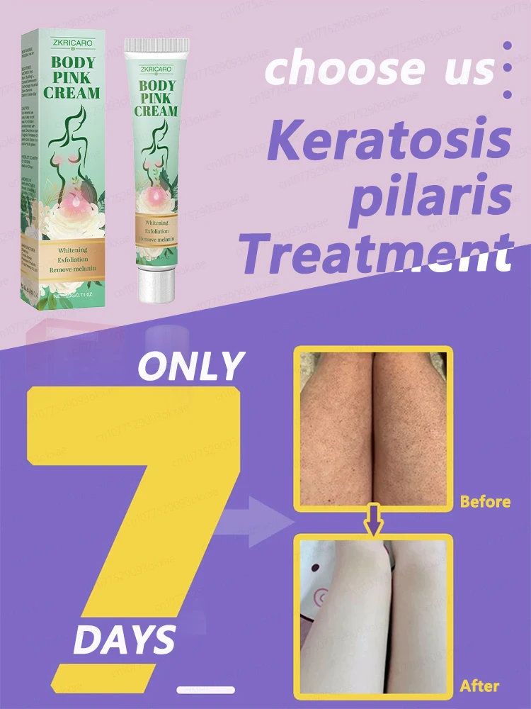 โลชั่นทาตัวขัดผิวซ่อมแซม Keratosis pilaris กำจัดขนลุกและขาสตรอเบอร์รี่