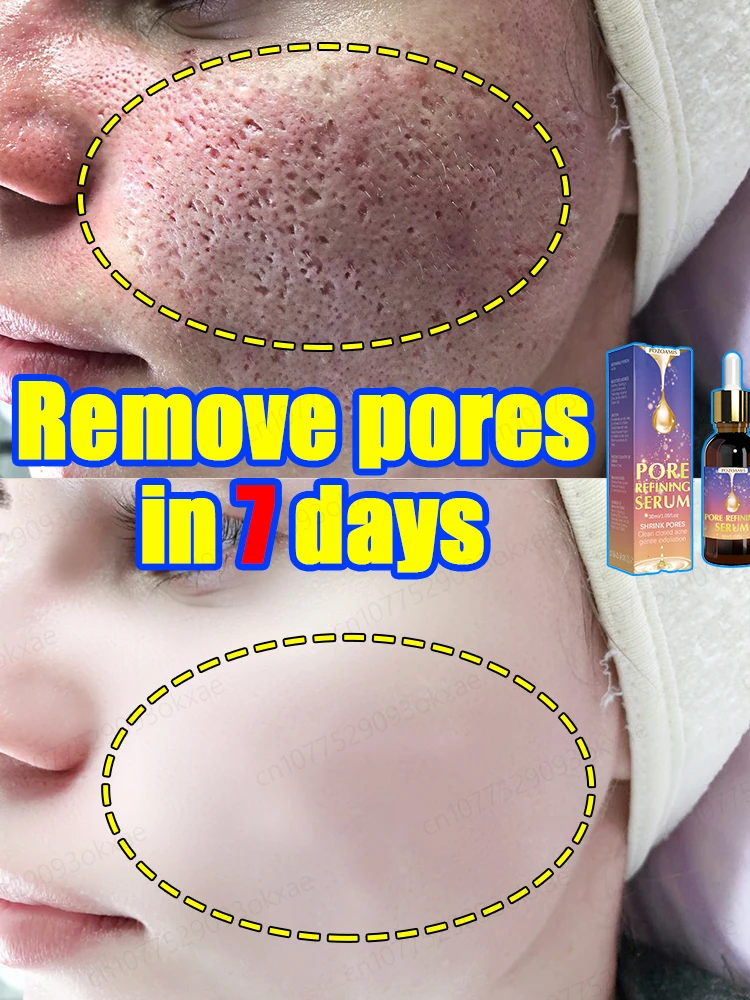 

pores remover pore shrinking serum shrink Tightening Minimizing