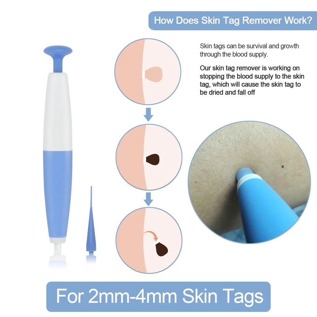 Skin Tag Remover Effective Face Care Mole Wart Tool Home Use Adult Painless Auto Band Skin Tag Removal Kit With Clean Swabs