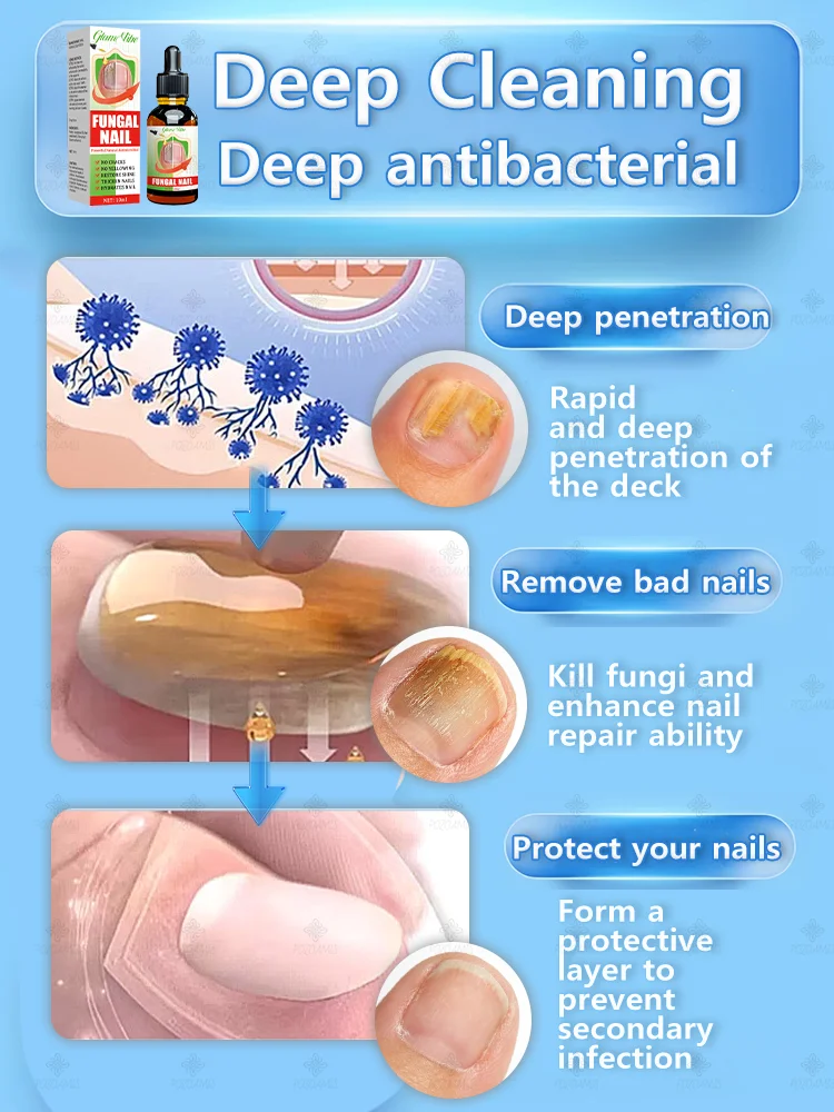 7일 만에 완고한 곰팡이 제거