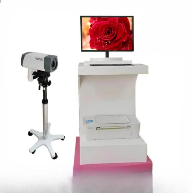 Digital electronic colposcopy high-definition color camera 3 million pixels