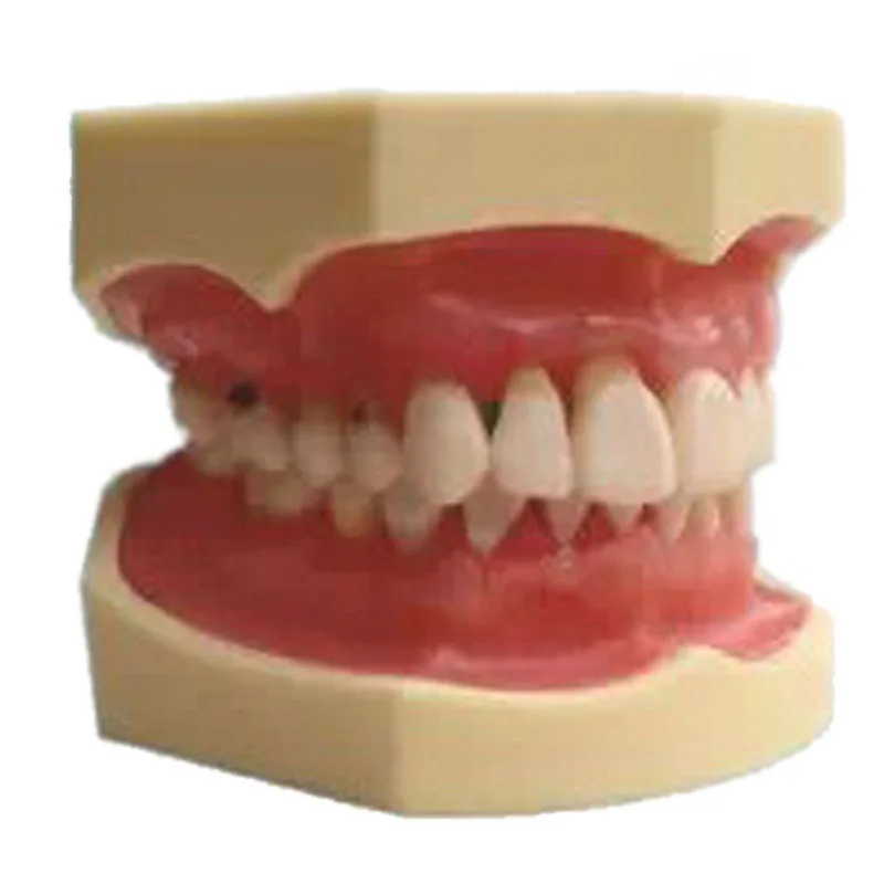 Educational Supplies Dental Training Periodontal Disease Model