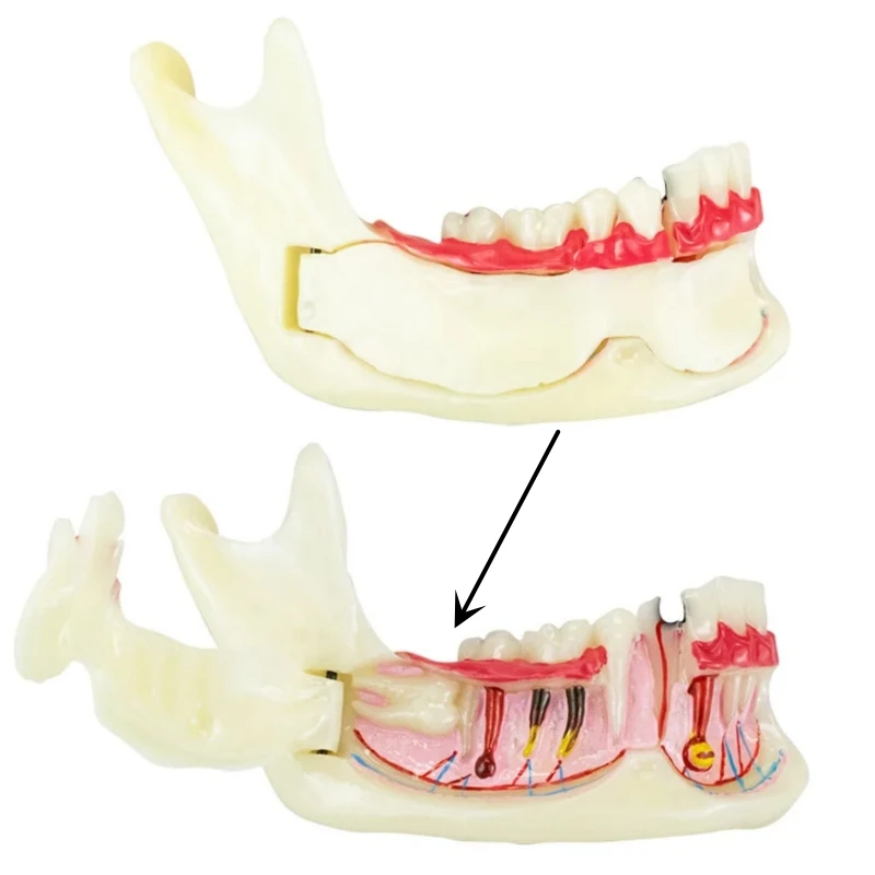 

Dental Endodontic Treatment Model Low Jaw Gingiva Mandible Tissue Anatomical Decomposition Model for Learning Teaching ﻿