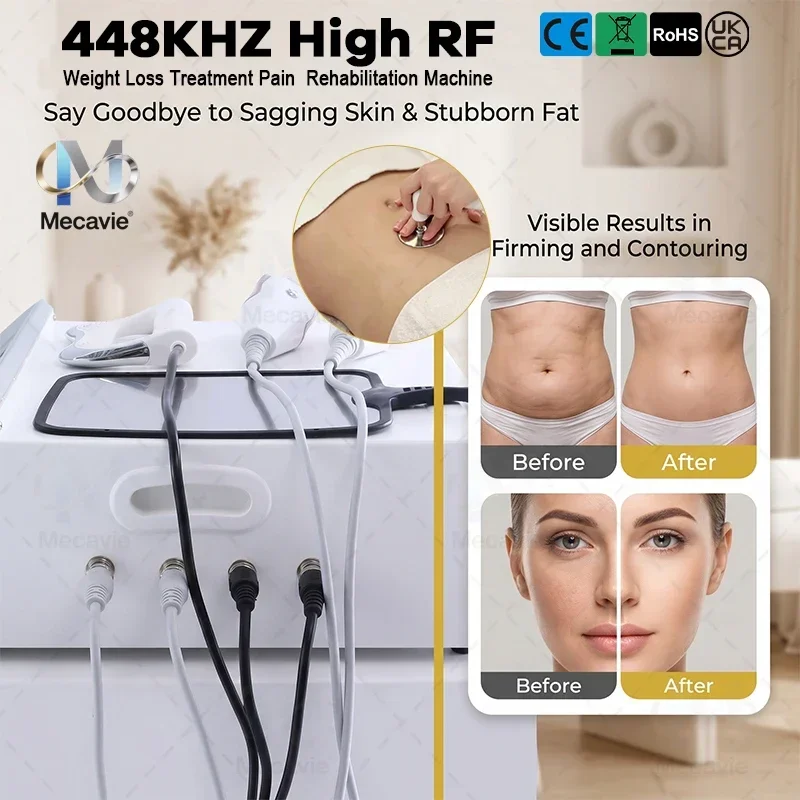 New Proionic 448KHz RF Fever Master Multi Probe Instrument Anti Aging Skin Tightening Body Shaping - view 4