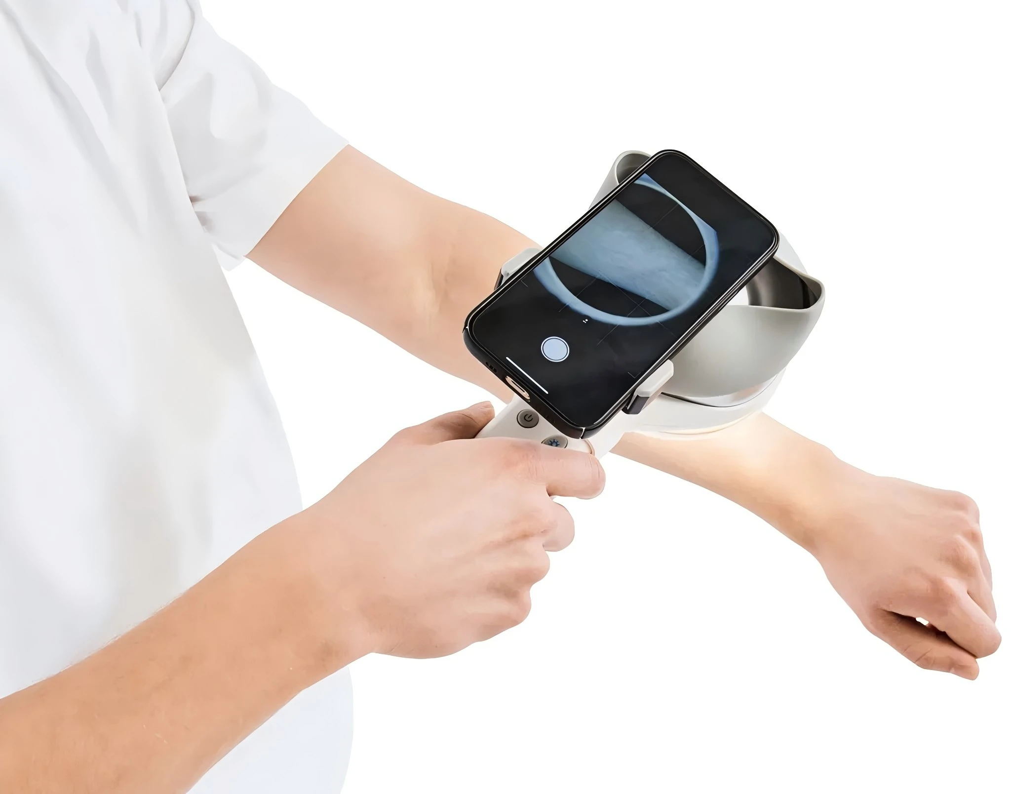 110 فولت-240 فولت مصباح وودز لطب الجلد بالأشعة فوق البنفسجية قابل لإعادة الشحن لامتحانات الكفة المصطبغة بصيلات أمراض الفطريات، بصيلات