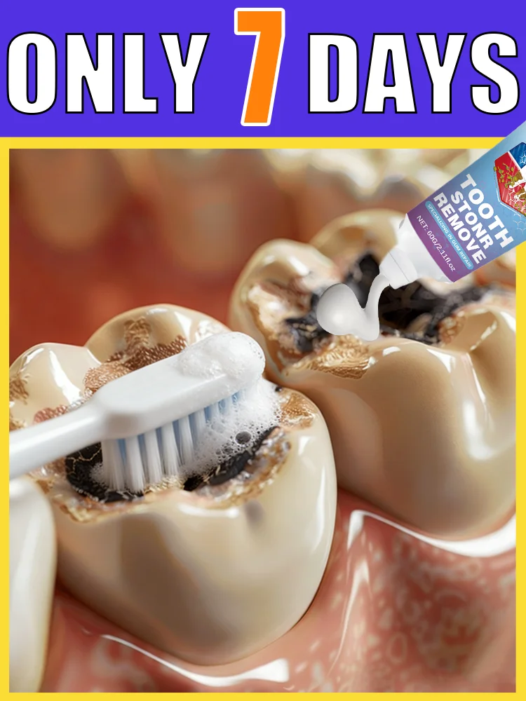 

Rᴇᴘᴀɪʀ ᴅᴇɴᴛᴀʟ ᴅᴇғᴇᴄᴛs ɪɴ ᴊᴜsᴛ 7 ᴅᴀʏs and regain a confident smile.