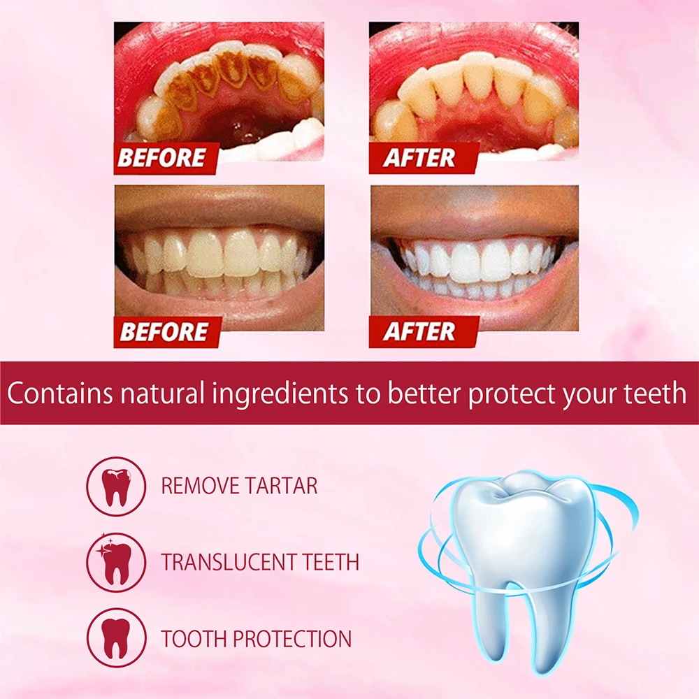 SP-4 Probiotic Whitening Tooth - Teeth Whitening Enzymes review and price