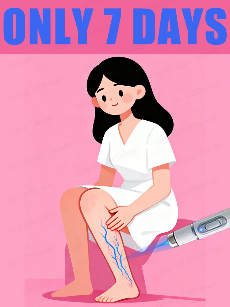 Generatie-2 Laser zegt vaarwel tegen spinnenpoten Spataderen in 7 dagen