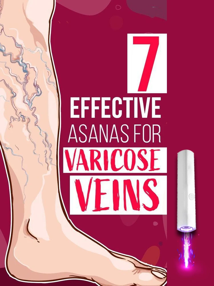 

Laser Therapy Veins Pen For Varicose Veins Chinese Herbal Essence Veins Cream 30g Relieves Spider Veins Leg Care
