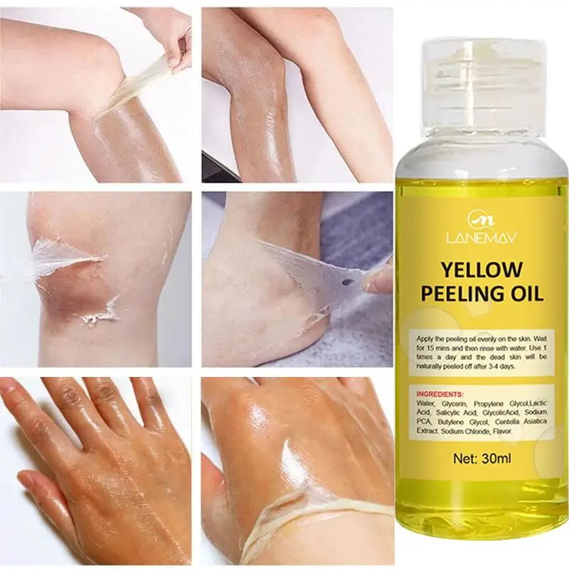 Óleo de peeling amarelo para pele escura, esfoliante, clareamento, manchas, joelho, dedo, remover a pele morta, melanina, clareamento, iluminar o corpo, cuidados com a pele