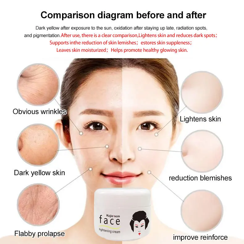 جديد حار حمض الكوجيك كريم وجه ترطيب النمش إزالة مكافحة الشيخوخة اشراق ترطيب كريمات الوجه منتجات العناية بالبشرة #5