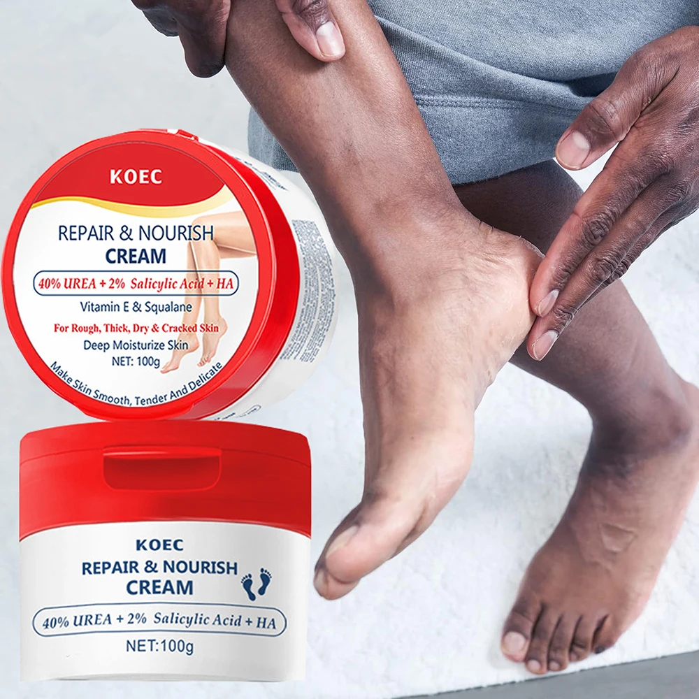 Cracked Foot Cream 40% Urea Ultra-hydrating Aloe Vera For Softening Dry Cracked Feet Gentle Exfoliation Daily Foot Care Cream