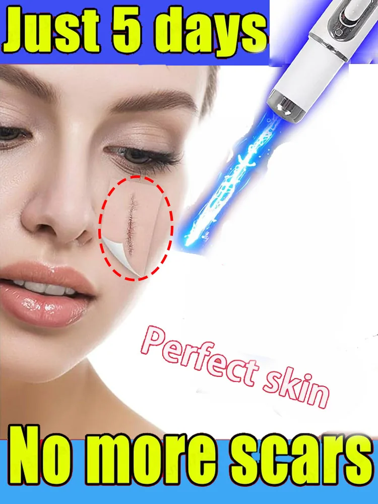 

Unisx Scar Pen Scar Relief Easy Harmless Laser Pointer