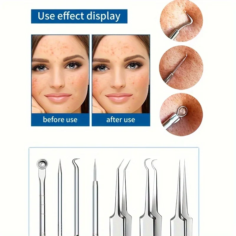 7個の黒ずみ除去ツール、金属製プロフェッショナルニキビ&コメドン除去ツール、無香料、サロン品質のフェイシャルケアキット