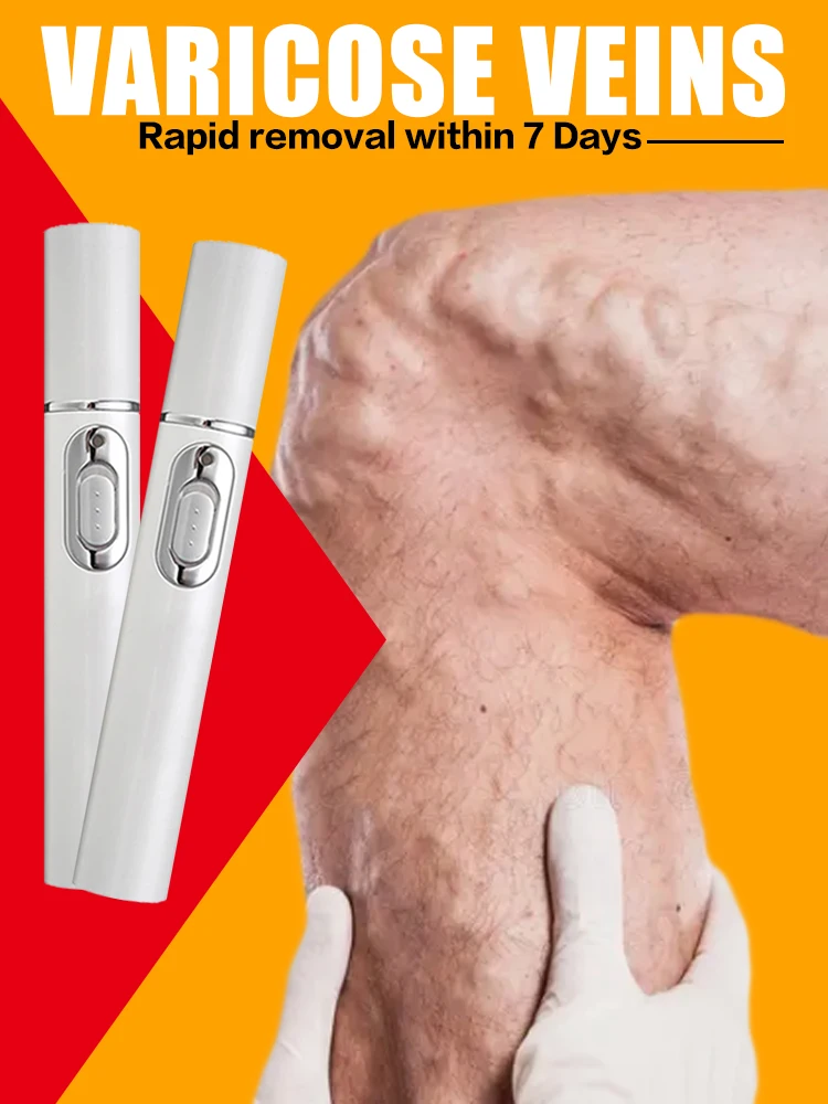 

Laser Therapy Leg Repair Pen Skin Care Product