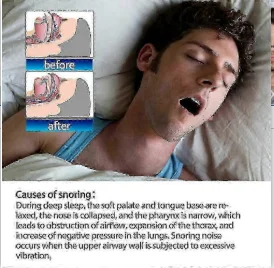 Thumbnail 2 - #20 Compare Snoring & Sleep Apnea Aids Before You Buy