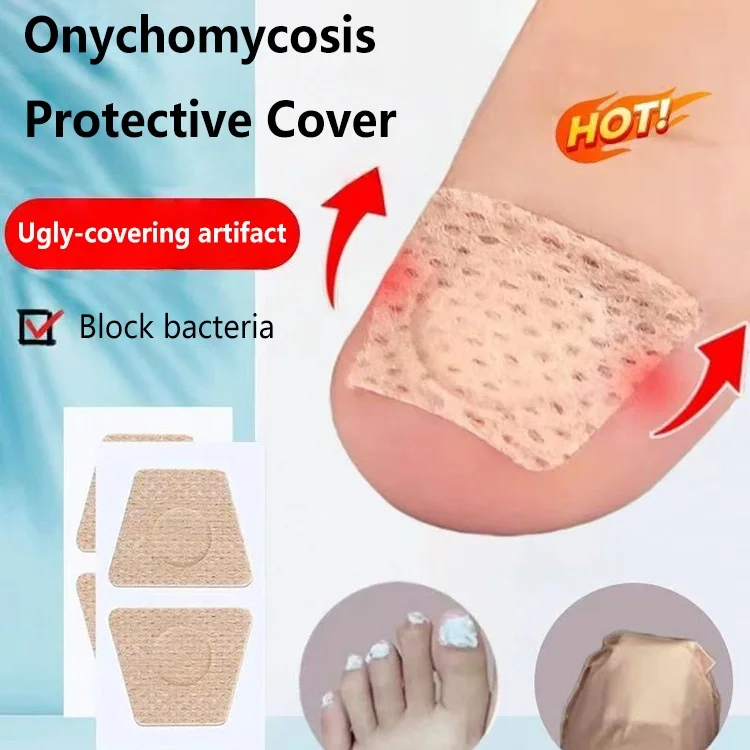 Toenail Fungus Patch Nail Repair Patches Nail Ingrown Correction Stickers For Discolored Damaged Nails Sticker Toenail Care image 2