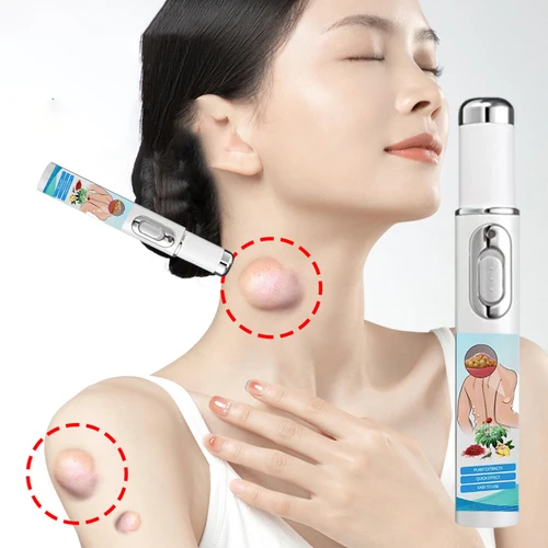 Imagen 2 del producto El puntero láser para eliminación de lipomas elimina eficientemente los fibromos de lipomas, grumos subcutáneos, cuidado de la salud corporal